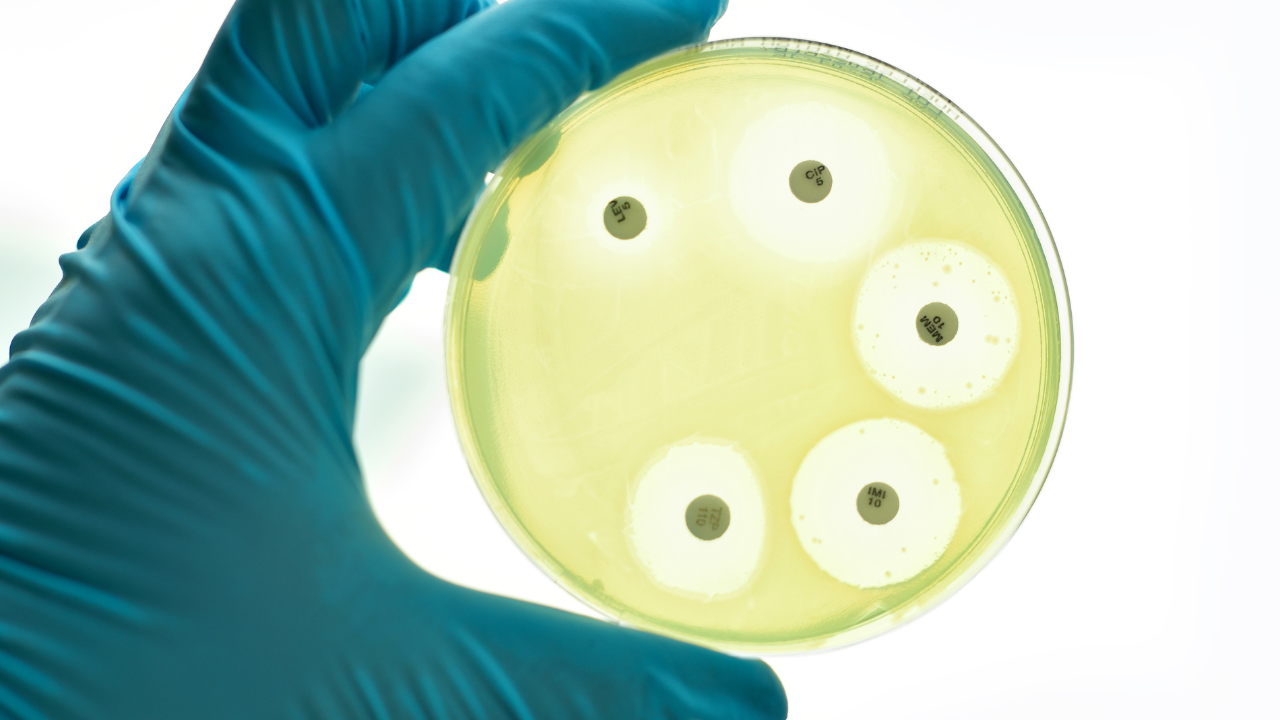 Résistance aux antimicrobiens (RAM) et qualité au laboratoire